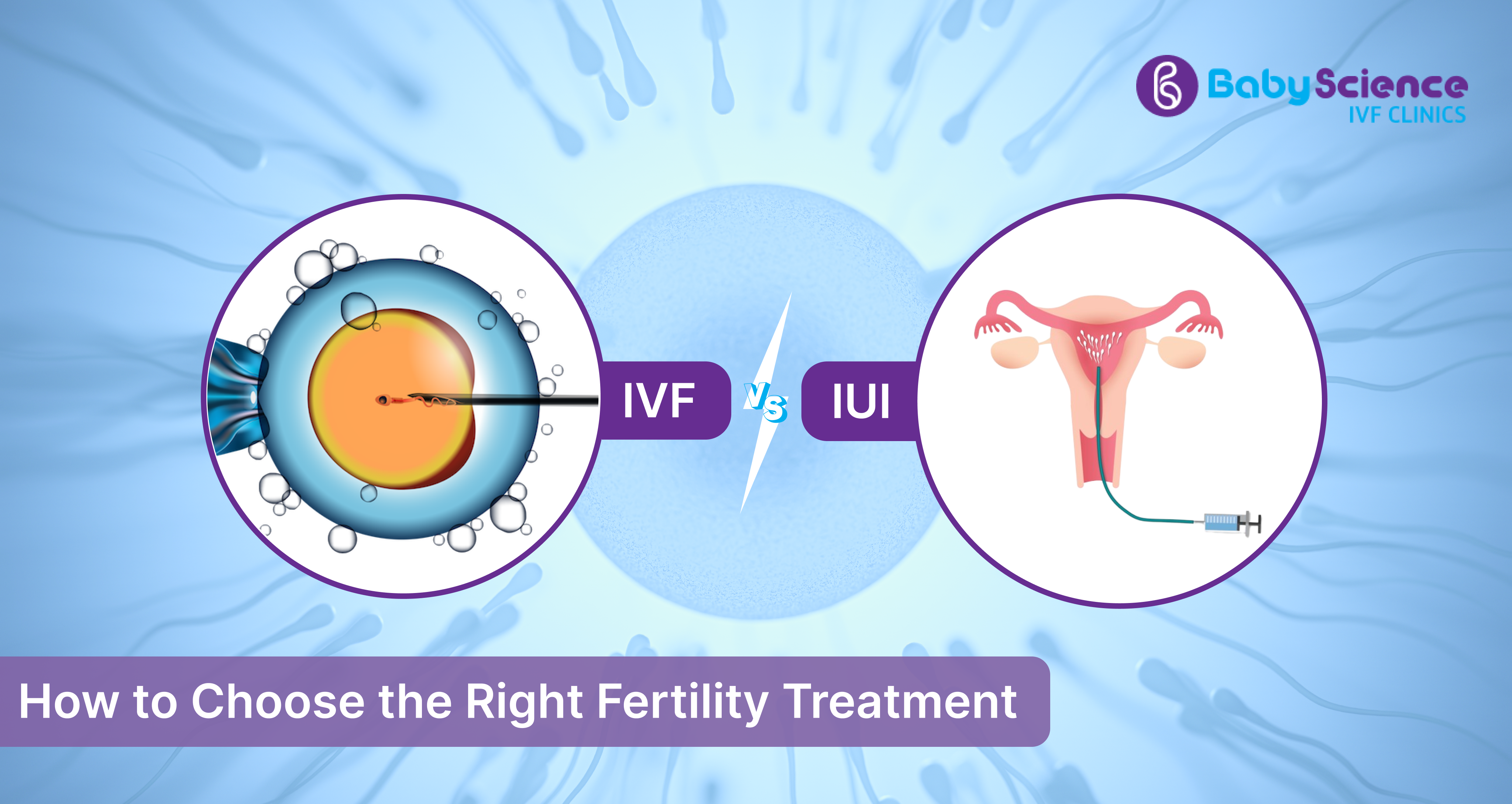  ivf cost in chennai